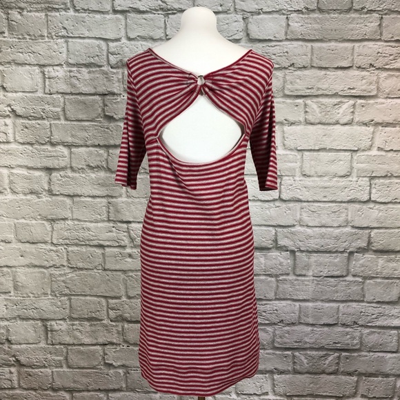 We The Free Frenchie Striped Open Back Dress - Picture 6 of 7
